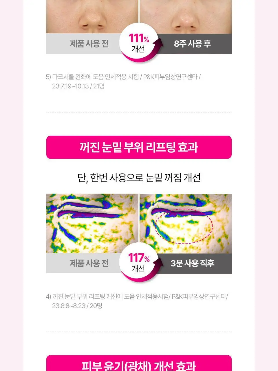 [퀭한눈가패치] 아이소이 블레미쉬 케어 아이&미간 패치 90매 더블 기획 상세페이지 17